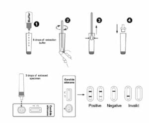 Hiivatulehdustestin tulosten lukeminen